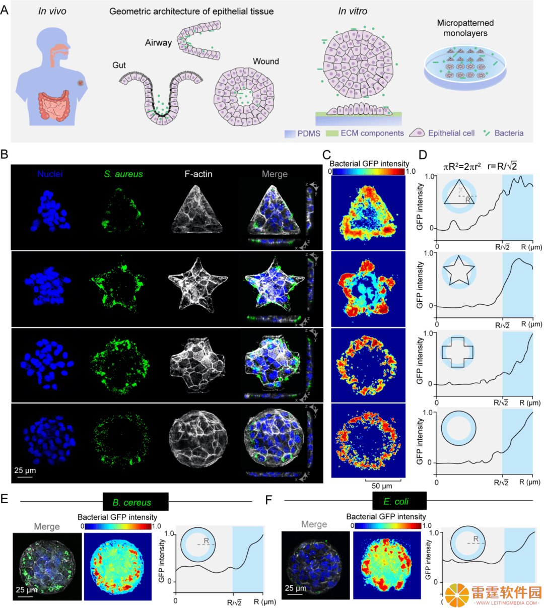 力学导航抗菌新突破：科学家发现细菌感染规律，精准递药应对肠道感染
